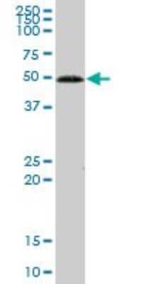 Western Blot: Glucokinase/GCK Antibody [H00002645-B02P] - Analysis of GCK expression in human liver.