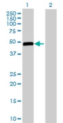 Western Blot: Glucokinase/GCK Antibody [H00002645-D01P] - Analysis of GCK expression in transfected 293T cell line by GCK polyclonal antibody.Lane 1: GCK transfected lysate(52.20 KDa).Lane 2: Non-transfected lysate.