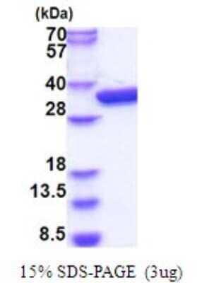 SDS-PAGE Recombinant E. coli Glucokinase/GCK His Protein