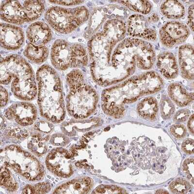 Immunohistochemistry: Glucosamine (N-acetyl)-6-Sulfatase/GNS Antibody [NBP2-38583] - Staining of human kidney shows strong cytoplasmic positivity in renal tubules.