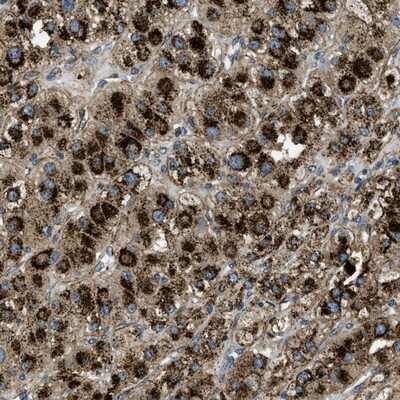 Immunohistochemistry-Paraffin: Glucosamine (N-acetyl)-6-Sulfatase/GNS Antibody [NBP1-86084] - Staining of human adrenal gland shows strong cytoplasmic positivity in granular pattern.