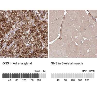 <b>Orthogonal Strategies Validation. </b>Immunohistochemistry-Paraffin: Glucosamine (N-acetyl)-6-Sulfatase/GNS Antibody [NBP2-38583] - Staining in human adrenal gland and skeletal muscle tissues using anti-GNS antibody. Corresponding GNS RNA-seq data are presented for the same tissues.