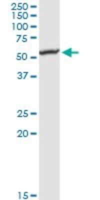 Western Blot: Glucosamine (N-acetyl)-6-Sulfatase/GNS Antibody [H00002799-D01P] - Analysis of GNS expression in human liver.