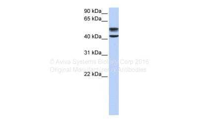 Western Blot: Glucosamine (N-acetyl)-6-Sulfatase/GNS Antibody [NBP1-69352] - Human liver.