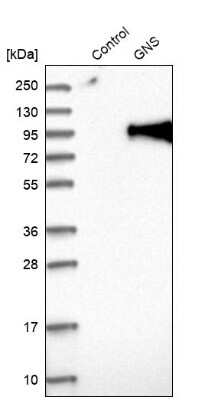 Western Blot: Glucosamine (N-acetyl)-6-Sulfatase/GNS Antibody [NBP1-86084] - Analysis in control (vector only transfected HEK293T lysate) and GNS over-expression lysate (Co-expressed with a C-terminal myc-DDK tag (3.1 kDa) in mammalian HEK293T cells).