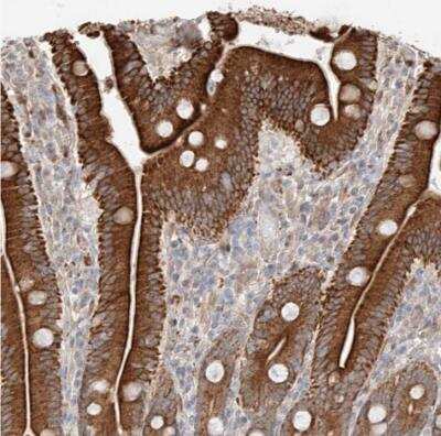 Immunohistochemistry-Paraffin: Glucosaminyl (N-acetyl) Transferase 1/GCNT1 Antibody [NBP1-86809] - Staining of human duodenum shows strong cytoplasmic positivity in glandular cells.