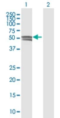 Western Blot Glucosaminyl (N-acetyl) Transferase 1/GCNT1 Antibody