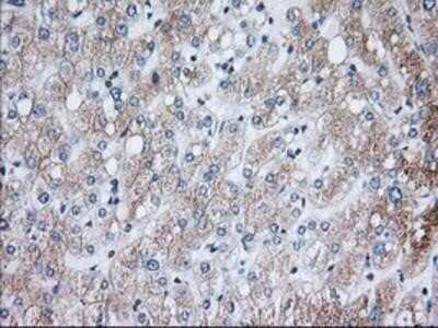 Immunohistochemistry: Glucose 1-dehydrogenase Antibody (OTI2A7) - Azide and BSA Free [NBP2-71478] - Staining of paraffin-embedded Human liver tissue using anti-Glucose 1-dehydrogenase mouse monoclonal antibody.