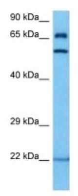 Western Blot: Glucose 6 Phosphate 1-Dehydrogenase 2 Antibody [NBP3-10177] - Western blot analysis of Glucose 6 Phosphate 1-Dehydrogenase 2 in Mouse Small Intestine lysates. Antibody dilution at 1ug/ml
