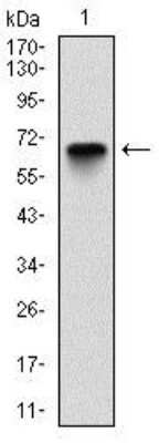 Western Blot: Glucose 6 Phosphate Dehydrogenase Antibody (2H7) - Azide and BSA Free [NBP2-80752] - Analysis using Glucose 6 Phosphate Dehydrogenase mAb against human Glucose 6 Phosphate Dehydrogenase (AA: 275-515) recombinant protein. (Expected MW is 53.1 kDa) Image from the standard format of this antibody.