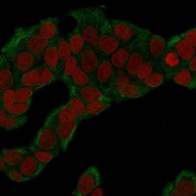 Immunocytochemistry/Immunofluorescence: Glucose 6 phosphate isomerase Antibody (CPTC-GPI-1) - Azide and BSA Free [NBP2-79845] - Immunofluorescence Analysis of human MCF-7 cells labeling GPI with Glucose 6 phosphate isomerase Antibody (CPTC-GPI-1) followed by Goat anti-Mouse IgG-CF488 (Green). The nuclear counterstain is RedDot (Red)