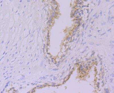 Immunohistochemistry: Glucose 6 phosphate isomerase Antibody (JG33-86) [NBP2-76840] - Immunohistochemical analysis of paraffin-embedded human prostate tissue using anti-Glucose 6 phosphate isomerase antibody. Counter stained with hematoxylin.