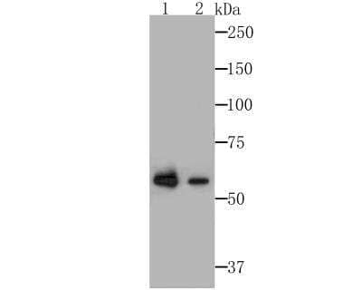 Western Blot: Glucose 6 phosphate isomerase Antibody (JG33-86) [NBP2-76840] - Western blot analysis of Glucose 6 phosphate isomerase on A549 and HepG2 cells lysates using anti-Glucose 6 phosphate isomerase antibody at 1/1,000 dilution.