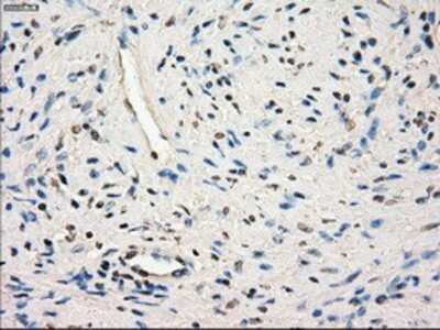 Immunohistochemistry-Paraffin: Glucose Transporter GLUT6 Antibody (7E3) [NBP1-47987] - Staining of paraffin-embedded prostate tissue using anti-Glucose Transporter GLUT6 mouse monoclonal antibody.