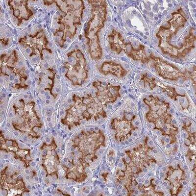 Immunohistochemistry: Glucose Transporter GLUT6 Antibody [NBP2-13327] - Staining of human kidney shows strong luminal membranous positivity in tubules.