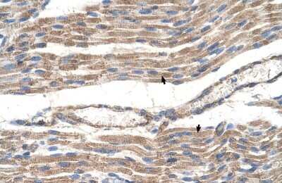 Immunohistochemistry-Paraffin: Glucose Transporter GLUT6 Antibody [NBP1-59891] - Human Muscle Tissue, Skeletal muscle cells (Indicated with Arrows) 4-8ug/ml.