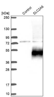 Western Blot: Glucose Transporter GLUT6 Antibody [NBP2-13327] - Analysis in control (vector only transfected HEK293T lysate) and SLC2A6 over-expression lysate (Co-expressed with a C-terminal myc-DDK tag (3.1 kDa) in mammalian HEK293T cells).