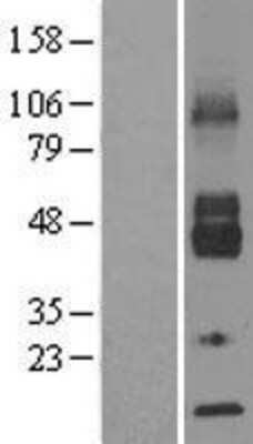 Western Blot: Glucose Transporter GLUT6 Overexpression Lysate (Adult Normal) [NBL1-16102] Left-Empty vector transfected control cell lysate (HEK293 cell lysate); Right -Over-expression Lysate for Glucose Transporter GLUT6.