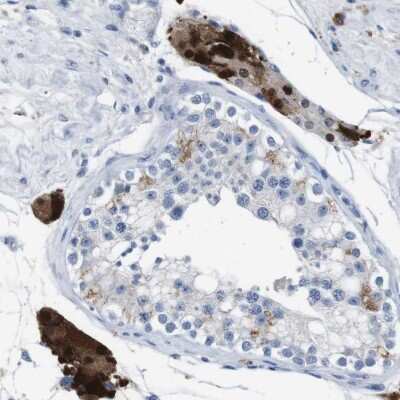 Immunohistochemistry-Paraffin: Glucose Transporter GLUT8 Antibody [NBP1-89760] - Staining of human testis shows strong nuclear and cytoplasmic positivity in cells of seminiferus ducts.