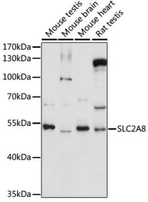 Western Blot: Glucose Transporter GLUT8 Antibody [NBP3-03554] - Analysis of extracts of various cell lines, using Glucose Transporter GLUT8 antibody at 1:1000 dilution. Secondary antibody: HRP Goat Anti-Rabbit IgG (H+L) at 1:10000 dilution. Lysates/proteins: 25ug per lane. Blocking buffer: 3% nonfat dry milk in TBST.