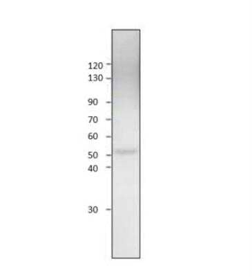 Western Blot: Glucose Transporter GLUT8 Antibody [NBP3-12470] - 1:500 antibody dilution in DiluObuffer.