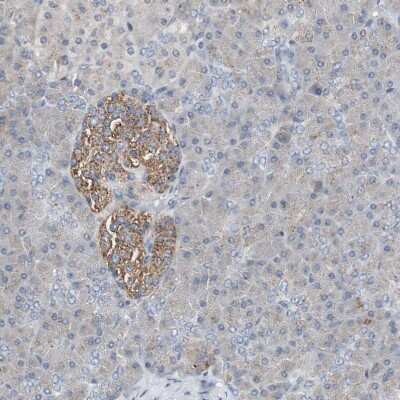 Immunohistochemistry-Paraffin: Glucosylceramidase/GBA Antibody [NBP1-83389] - Staining of human pancreas shows moderate granular cytoplasmic positivity in islets of Langerhans.