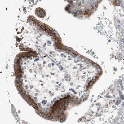 Immunohistochemistry-Paraffin: Glucosylceramidase/GBA Antibody [NBP1-83389] - Staining of human placenta shows strong granular cytoplasmic positivity in trophoblastic cells.