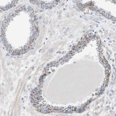 Immunohistochemistry-Paraffin: Glucosylceramidase/GBA Antibody [NBP1-83389] - Staining of human prostate shows moderate granular cytoplasmic positivity in glandular cells.