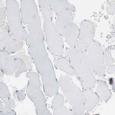 Immunohistochemistry-Paraffin: Glucosylceramidase/GBA Antibody [NBP1-83389] - Staining of human skeletal muscle shows no positivity in myocytes as expected.