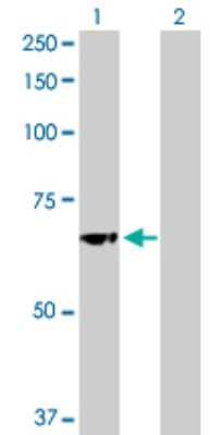 Western Blot: Glucosylceramidase/GBA Antibody [H00002629-D01P] - Analysis of GBA expression in transfected 293T cell line by GBA rabbit polyclonal antibody.Lane 1: GBA transfected lysate(59.70 KDa).Lane 2: Non-transfected lysate.