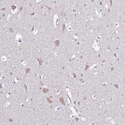 Immunohistochemistry-Paraffin: Glucuronic Acid Epimerase Antibody [NBP2-31872] - Staining of human cerebral cortex shows cytoplasmic positivity in neuronal cells.