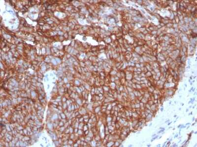 Immunohistochemistry-Paraffin: Glut1 Antibody (GLUT1/3132R) - Azide and BSA Free [NBP3-08502] - Formalin-fixed, paraffin-embedded human Tongue stained with Glut1 Recombinant Rabbit Monoclonal Antibody (GLUT1/3132R).