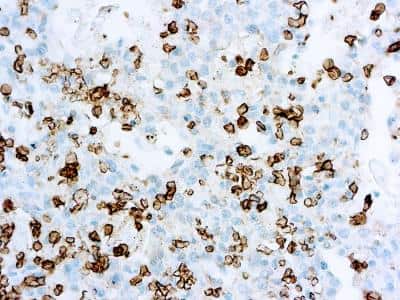 Immunohistochemistry-Paraffin: Glut1 Antibody [NB120-15309] - Immunohistochemical analysis of formalin fixed paraffin embedded human bladder stained with GLUT-1 antibody (NB120-15309).