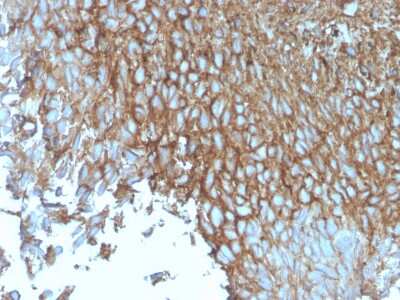Immunohistochemistry-Paraffin: Glut1 Antibody (rGLUT1/2476) - Azide and BSA Free [NBP3-08479] - Formalin-fixed, paraffin-embedded human Bladder stained with Glut1 Mouse Monoclonal Antibody (rGLUT1/2476).
