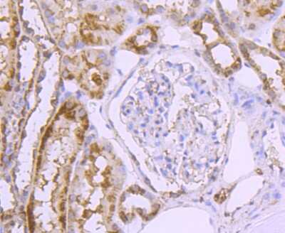 Immunohistochemistry-Paraffin: Glut2 Antibody (JJ20-21) [NBP2-67860] - Analysis of paraffin-embedded human kideny tissue using anti-GLUT2 antibody. Counter stained with hematoxylin.