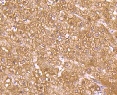 Immunohistochemistry-Paraffin: Glut2 Antibody (JJ20-21) [NBP2-67860] - Analysis of paraffin-embedded human liver tissue using anti-GLUT2 antibody. Counter stained with hematoxylin.