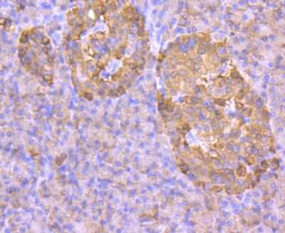 Immunohistochemistry-Paraffin: Glut2 Antibody (JJ20-21) [NBP2-67860] - Analysis of paraffin-embedded human pancreas tissue using anti-GLUT2 antibody. Counter stained with hematoxylin.
