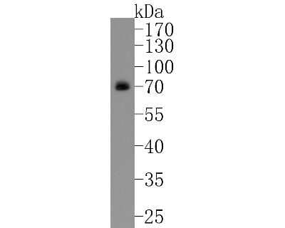 Western Blot: Glut2 Antibody (JJ20-21) [NBP2-67860] - Western blot analysis of Glut2 on HepG2 cell lysates. Proteins were transferred to a PVDF membrane and blocked with 5% BSA in PBS for 1 hour at room temperature. The primary antibody (1/500) was used in 5% BSA at room temperature for 2 hours. Goat Anti-Ra