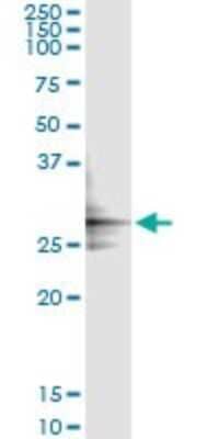 Immunoprecipitation: Glutamate Dehydrogenase 2/GLUD2 Antibody (3C2) [H00002747-M01] - Analysis of GLUD2 transfected lysate using anti-GLUD2 monoclonal antibody and Protein A Magnetic Bead, and immunoblotted with GLUD2 MaxPab rabbit polyclonal antibody.