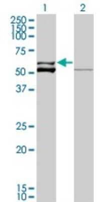 Western Blot: Glutamate Dehydrogenase 2/GLUD2 Antibody (3C2) [H00002747-M01] - Analysis of GLUD2 expression in transfected 293T cell line by GLUD2 monoclonal antibody (M01), clone 3C2.Lane 1: GLUD2 transfected lysate(61 KDa).Lane 2: Non-transfected lysate.