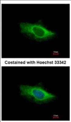 Immunocytochemistry/Immunofluorescence: Glutamate Dehydrogenase 2/GLUD2 Antibody [NBP2-16678] - Analysis of methanol-fixed HeLa, using antibody at 1:500 dilution.