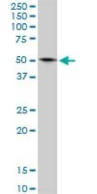 Western Blot: Glutamate Dehydrogenase 2/GLUD2 Antibody [H00002747-B02P] - Analysis of GLUD2 expression in A-431.