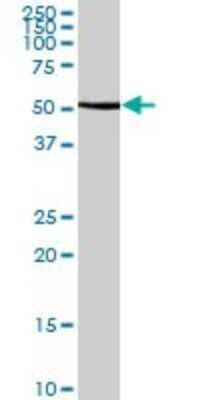 Western Blot: Glutamate Dehydrogenase 2/GLUD2 Antibody [H00002747-B02P] - Analysis of GLUD2 expression in human kidney.