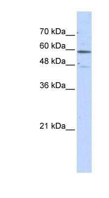 Western Blot: Glutamate Dehydrogenase 2/GLUD2 Antibody [NBP1-55437] -  Transfected 293T cell lysate, concentration 0.2-1 ug/ml.