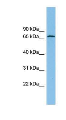 Western Blot: Glutamate Dehydrogenase 2/GLUD2 Antibody [NBP1-57732] -  RPMI 8226 cell lysate, concentration 0.2-1 ug/ml.