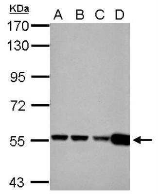 Western Blot: Glutamate Dehydrogenase 2/GLUD2 Antibody [NBP2-16678] - A: 293T B: A431 C: HeLa D: HepG2.