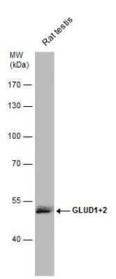 Western Blot: Glutamate Dehydrogenase 2/GLUD2 Antibody [NBP2-16678] - Rat tissue extract (50 ug) was separated by 7.5% SDS-PAGE, and the membrane was blotted with Glutamate Dehydrogenase 2 antibody diluted at 1:1000. HRP-conjugated anti-rabbit IgG antibody was used to detect the primary antibody.