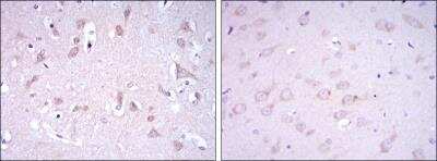 Immunohistochemistry-Paraffin: Glutamate Receptor 3 Antibody (1D2) [NBP2-37584] - Immunohistochemical analysis of paraffin-embedded human brain tissues (left) and rat brain tissues (right) using GRIA3 mouse mAb with DAB staining.