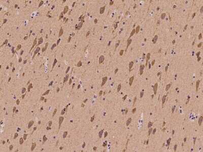 Immunohistochemistry-Paraffin: Glutamate Receptor 6 Antibody [NBP2-98590] - Immunochemical staining of human Glutamate Receptor 6 in human brain with rabbit polyclonal antibody at 1:100 dilution, formalin-fixed paraffin embedded sections.