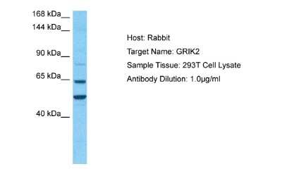 Western Blot: Glutamate Receptor 6 Antibody [NBP2-87512] - Host: Rabbit. Target Name: GRIK2. Sample Type: 293T Whole Cell lysates. Antibody Dilution: 1.0ug/ml